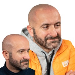 Client de Nat Lambert Tricopigmentation