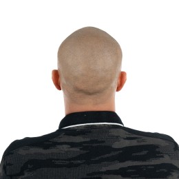 Client de Nat Lambert Tricopigmentation