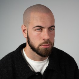 Client de Nat Lambert Tricopigmentation