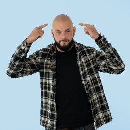 Client de Nat Lambert Tricopigmentation