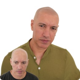 Client de Nat Lambert Tricopigmentation