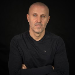 Client de Nat Lambert Tricopigmentation