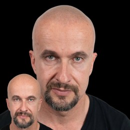 Client de Nat Lambert Tricopigmentation