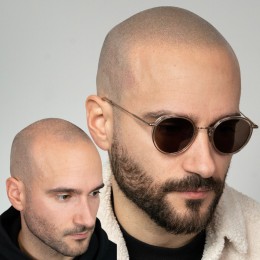 Client de Nat Lambert Tricopigmentation