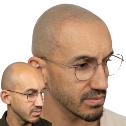 Client de Nat Lambert Tricopigmentation