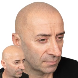 Client de Nat Lambert Tricopigmentation