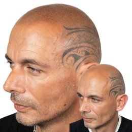 Client de Nat Lambert Tricopigmentation