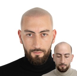 Client de Nat Lambert Tricopigmentation