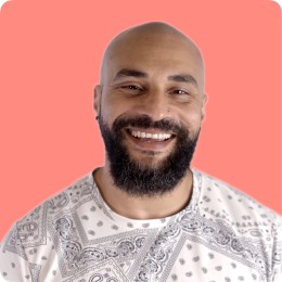 Client de Nat Lambert Tricopigmentation