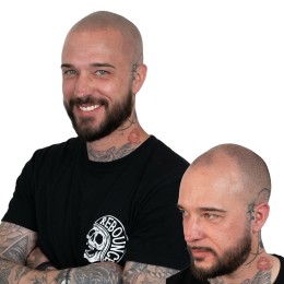 Client de Nat Lambert Tricopigmentation