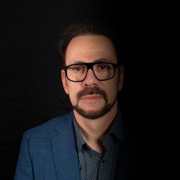 Client de Nat Lambert Tricopigmentation