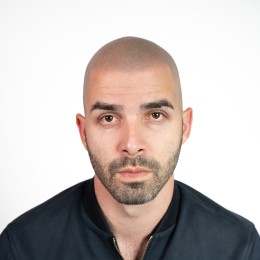 Client de Nat Lambert Tricopigmentation