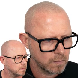 Client de Nat Lambert Tricopigmentation