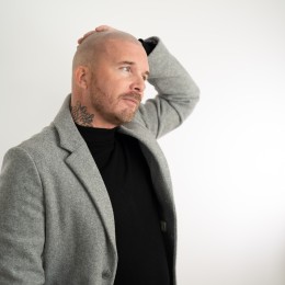 Client de Nat Lambert Tricopigmentation