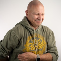 Client de Nat Lambert Tricopigmentation