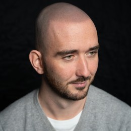 Client de Nat Lambert Tricopigmentation